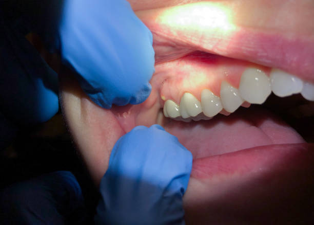 Best Emergency Pediatric Dental Care in Omaha, TX